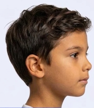 Perfil del mismo niño con la boca cerrada después de treinta noches